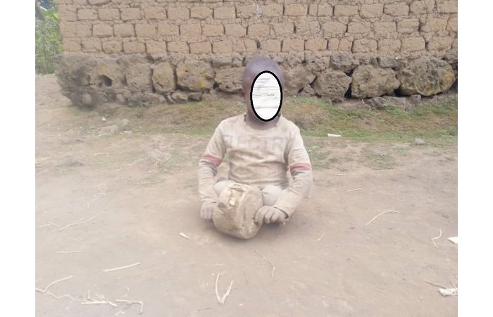 Intabaza ku mibereho y’umwana muto w’i Musanze  wagonzwe n’imodoka ikamuca amaguru 