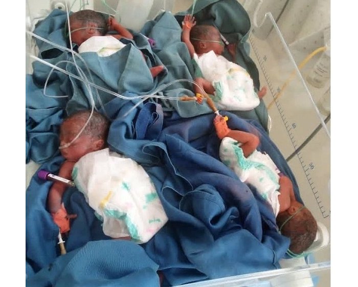 Umunyarwandakazi  yabyaye impaga z’abana bane umwe yitaba Imana