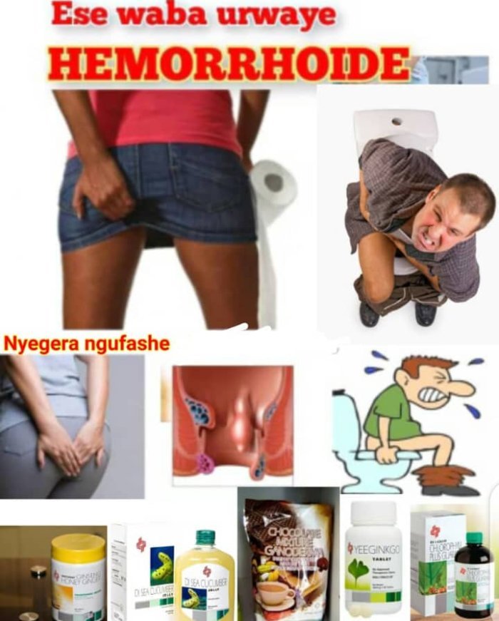 Sobanukirwa ibiteye inkeke n’amatsiko ku ndwara ya EMOROYIDE n’uko wayirinda