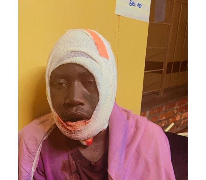 Musanze&nbsp;: Umuturage  arembeye  mu Bitaro nyuma yo gukomeretswa n’imbogo