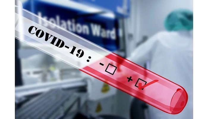 Covid-19&nbsp;: Mu Rwanda habonetse 2 banduye ku Isi barenze miliyoni 2