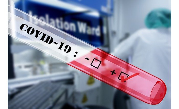 Mu Rwanda abarwaye coronavirus bamaze kurenga 100