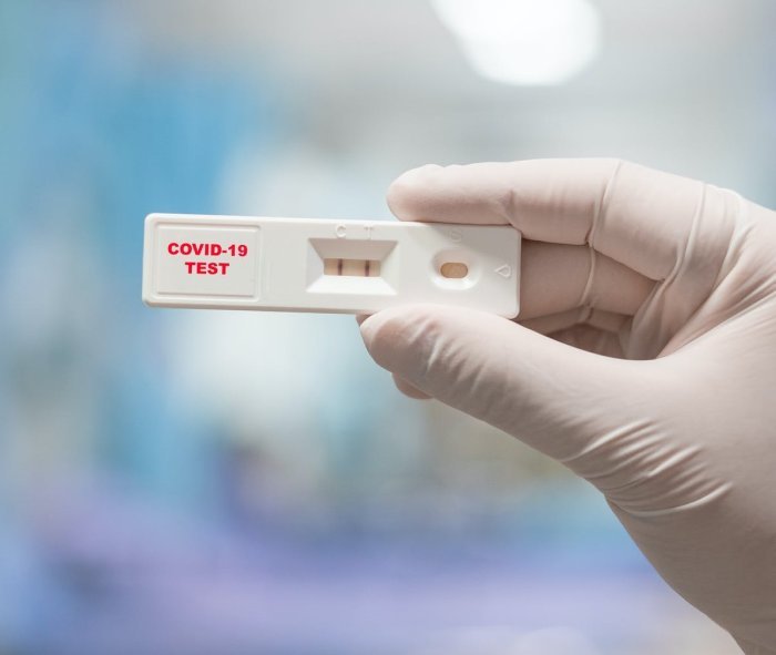 COVID-19 : Ku Cyumweru habonetse abanduye bashya 2.773, hapfa 11