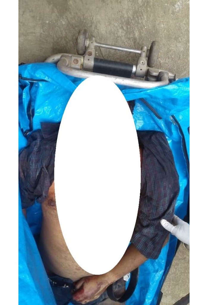 Kigali&nbsp;: Umuhinde wahanutse muri etage agapfa, birakekwa ko yiyahuye 