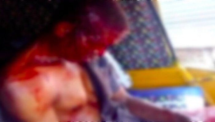 Umusore wakubiswe n’indaya yanze kuyishyura yapfiriye mu bitaro