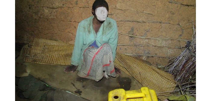 Musanze&nbsp;: Habiyambere yamaze  imyaka afungiranye mu nzu bimuviramo ubumuga n’ihungabana