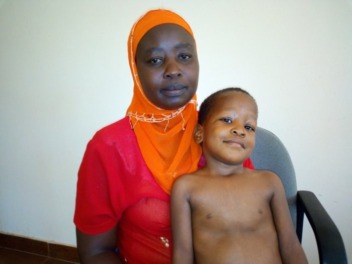 Nzamukosha aratabariza umwana we ufite imyenge 2 ku mutima woherejwe kuvurizwa mu Buhinde