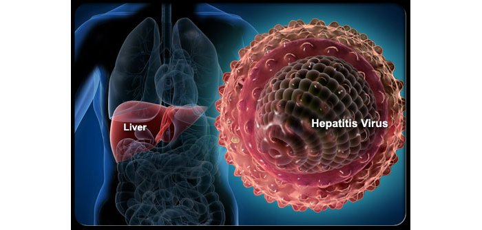 Menya ibyo wakoresha ugahangana n’indwara y’umwijima ya Hepatite B yibasiye benshi