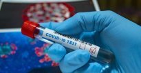 Umuntu wa 31 yishwe na Coronavirus mu Rwanda 