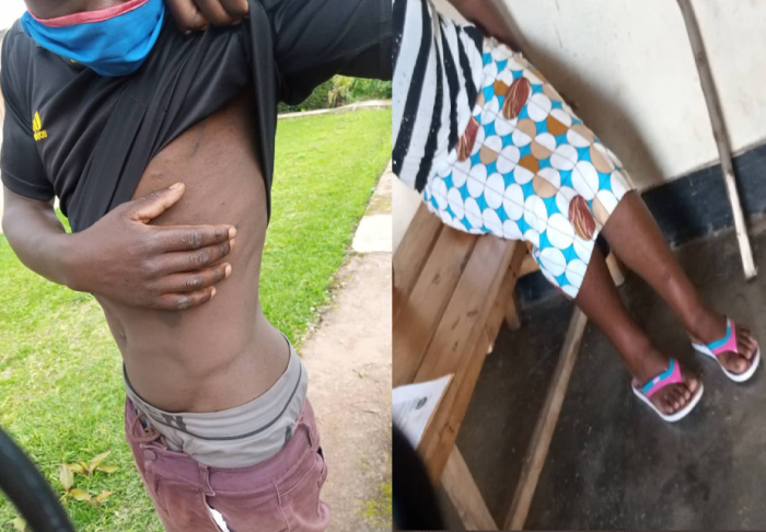 RIB yataye muri yombi abayobozi bakubise abaturage batambaye udupfukamunwa 