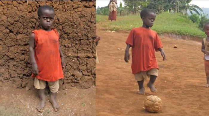 Ubumuga bwe butuma benshi badapfa kumenya ko afite imyaka 20 y’amavuko