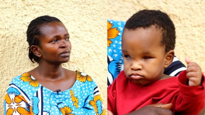  Kigali&nbsp;: Ugusiragizwa no kurangarana umubyeyi wabyaye umwana utagejeje igihe bimuviramo uburwayi budasanzwe