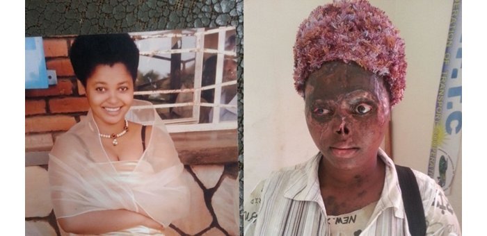 Ntakirutimana watwikishijwe aside yagobotswe na MINISANTE ariko aracyahangayitse cyane