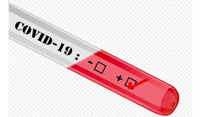 Uganda&nbsp;: Abanduye coronavirus bazamutse bageze kuri 14 barimo uruhinja rwandujwe na se