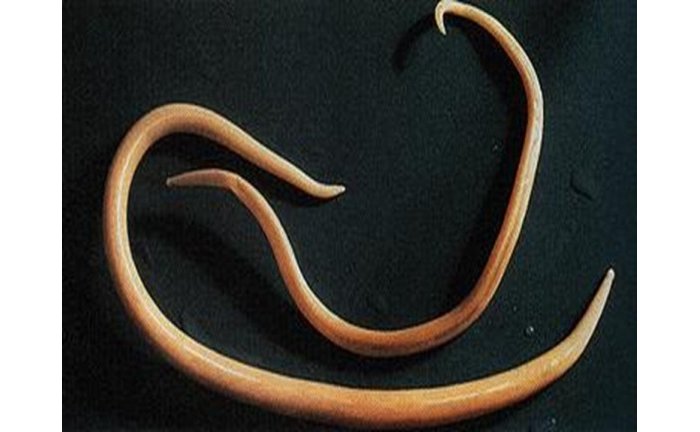 Hagaragajwe umubare wo hejuru w’Abanyarwanda barwaye inzoka zo mu nda