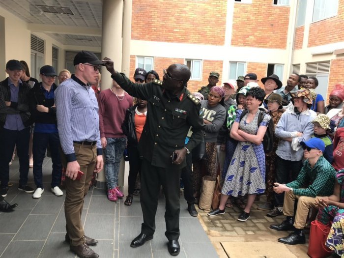 Kigali&nbsp;: Abafite ubumuga bw’ uruhu bari gupimwa indwara zibibasira 