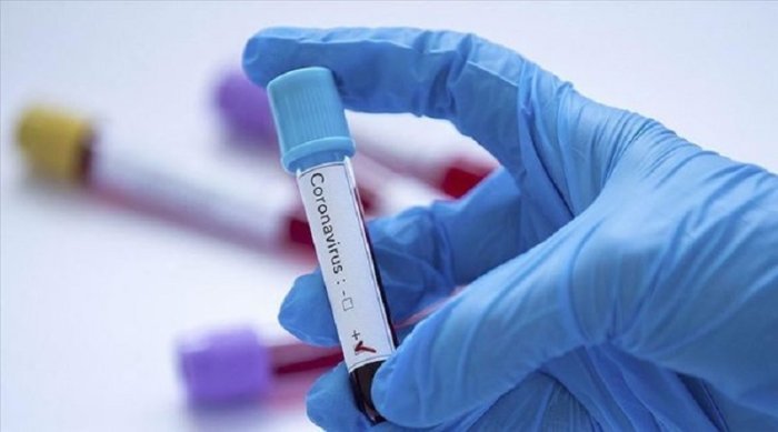 COVID19&nbsp;: Hongeye kuboneka abantu benshi banduye iki cyorezo mu Rwanda