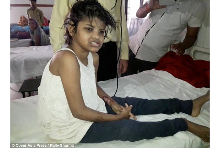 Ubuzima bw’umukobwa ufite imyitwarire nk’iyinyamaswa kubera kurerwa n’inkende