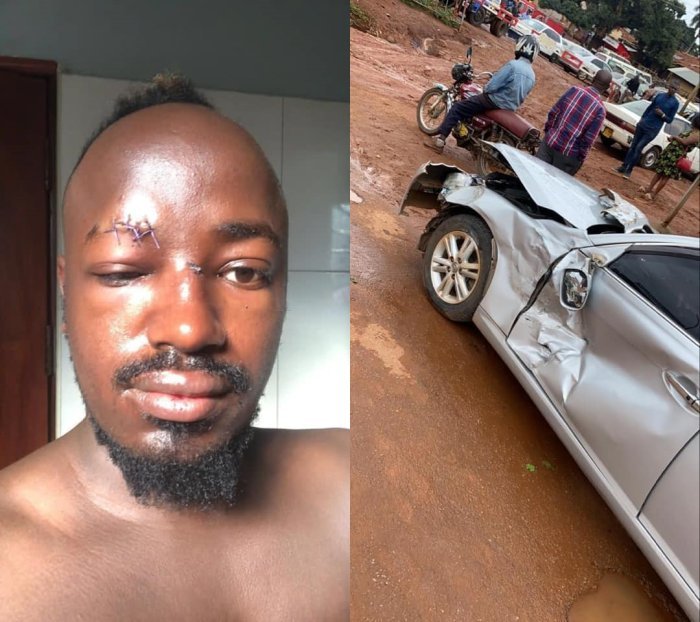  Mu mafoto&nbsp;: Umuhanzi YKee Benda yari aguye mu mpanuka Imana ikinga ukuboko