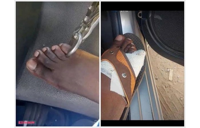 AKUMIRO&nbsp;!  Zimbabwe  ngo  bagurisha amano kubera ubushomeri 