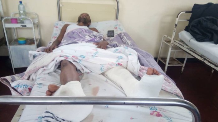 Arembeye mu bitaro nyuma yo gukubitwa n’ abanyerondo b’ umwuga bamusanze iwe 