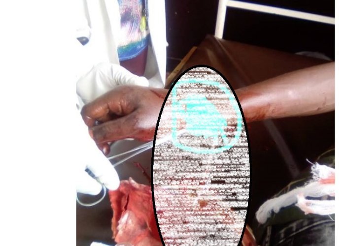 Kayonza&nbsp;: Umugabo aravugwaho kujya kwiba akinjiza akaboko mu nzu bagahita bagatema