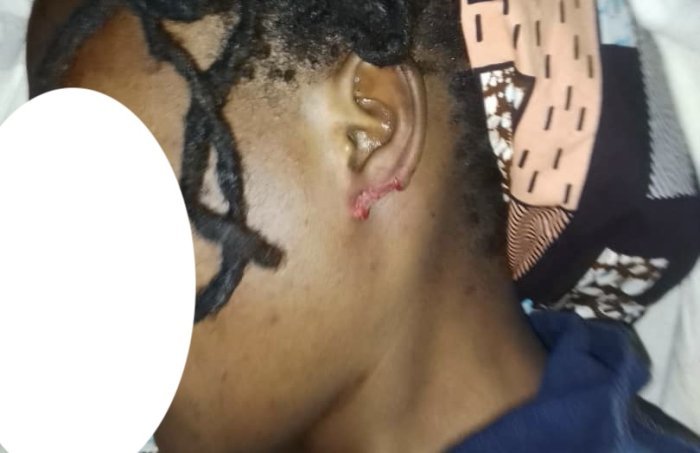 Umwarimu uvugwaho kuruma umugore we ugutwi agacaho agace akomeje kuvugisha benshi