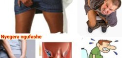 Sobanukirwa ibiteye inkeke n’amatsiko ku ndwara ya EMOROYIDE n’uko wayirinda