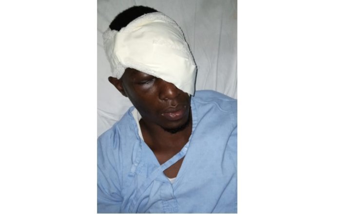 Kamonyi&nbsp;: Umuturage wamenwe ijisho na DASSO barikuyemo ubu arembeye kwa muganga