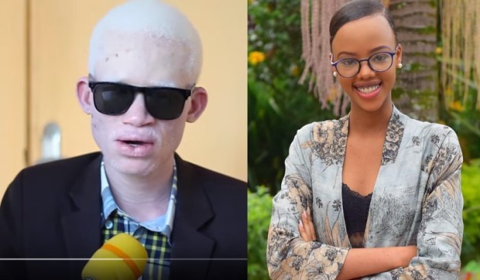 Akarabyokimana wagurishijwe na se kubera ubumuga bw’ uruhu yanenze Miss Jolly na bagenzi be [VIDEO]