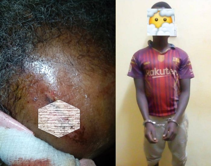 Huye&nbsp;: Umushumba wakubise inkoni mu mutwe umusaza yafashwe nyuma y’uko bitangajwe kuri Twitter