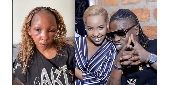 Ibya Teta Sandra na Weasel byafashe indi ntera, Umuryango Mpuzamahanga wabyinjiyemo 