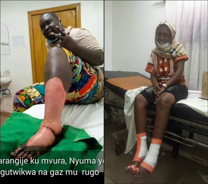 Uburyo umunyamakuru Bertrand n’umugore we batwitswe na Gaz bikwiye kubera buri wese isomo - VIDEO